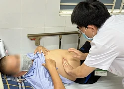 Nghiện ăn rau muống sống, người đàn ông mang ổ sán lớn ở gan