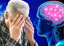 Phát hiện mới mang lại triển vọng phát triển phương pháp trị bệnh Alzheimer