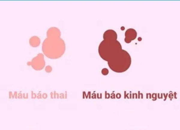 Phân biệt máu báo mang thai và ra máu kinh nguyệt