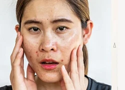 Các bước skincare cho da khô đúng chuẩn theo chuyên gia da liễu