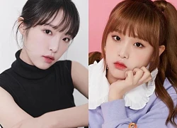 Choi Yena: Cựu thành viên IZ*ONE từng mắc ung thư, bị nghi "đổi tình lấy tiếng"