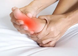 Bệnh gout có gây rối loạn cương dương không?