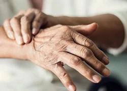 Khuyến nghị mở rộng xét nghiệm di truyền để phát hiện sớm bệnh Parkinson