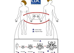 Bệnh rận mu sinh dục và cách ngăn ngừa chúng quay trở lại