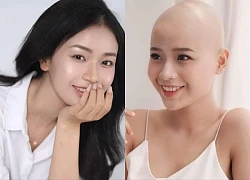 Cô gái từng chiến thắng ung thư nói lý do thi Miss Grand Vietnam