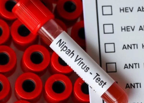 Ấn Độ ghi nhận ca tử vong do virus Nipah