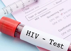 Xét nghiệm HIV tại nhà có chính xác không?