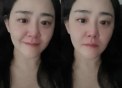 Bức ảnh gây lo lắng tột độ của "Em gái quốc dân" Moon Geun Young