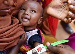 UNICEF: Ít nhất 77 triệu trẻ em tại Trung Đông và Bắc Phi bị suy dinh dưỡng