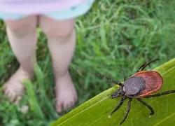 Virus mới phát hiện tại Trung Quốc có thể gây tổn thương não