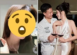 Nam Em 'sưng mắt' vì tình cũ, chia tay bị đòi nợ, nghi vấn phát 'bệnh tâm lý'?