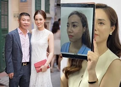 Vợ Công Lý phẫu thuật thẩm mỹ hậu tin đồn ly dị, nói rõ chuyện sinh con