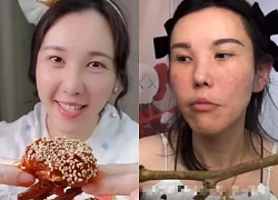 Cô gái bị biến dạng khuôn mặt sau 2 năm làm mukbang, lý do ai nghe cũng sốc