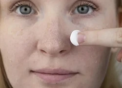 Da nhạy cảm có nên dùng mỹ phẩm chứa collagen?