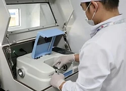 Dùng máy quang phổ hồng ngoại FTIR để phân tích sỏi tiết niệu