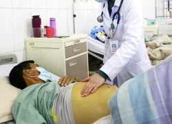 Xơ gan chữa thế nào?