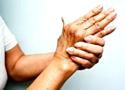 6 mẹo đơn giản giúp giảm đau khớp hiệu quả trong mùa lạnh