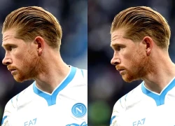 De Bruyne khiến Napoli mất bộn tiền