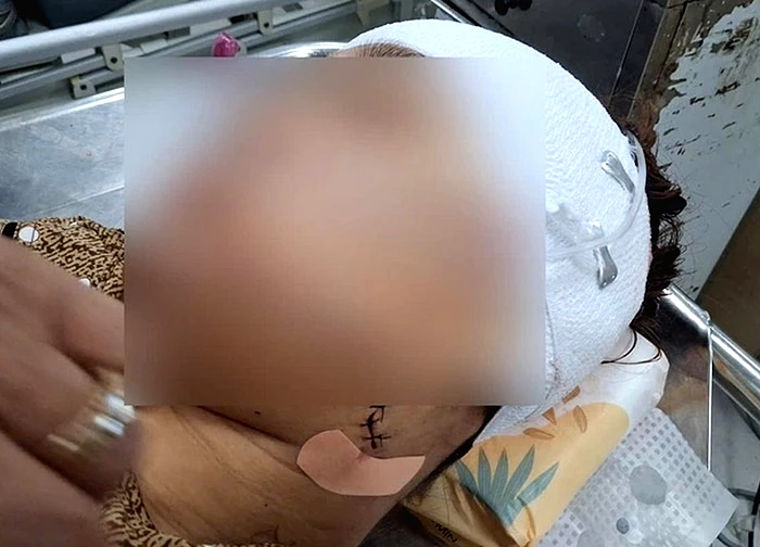 Điều tra vụ nữ công chức rạch mặt bạn gái của chồng gây thương tích nặng