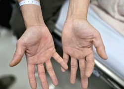 Hai vợ chồng nhập viện vì cùng 1 'thú vui'