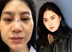 Diễn viên Phi Ngọc Ánh bị chồng cũ ra tay, livestream cầu cứu cộng đồng mạng