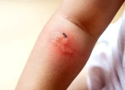 Một phường ở TP.HCM có 3 ổ dịch tại trường học chỉ trong 1 tuần