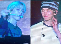 Nam thần Kpop sang Việt Nam vấp chân suýt vồ ếch trên sân khấu, mẩn đỏ dị ứng lan khắp cổ