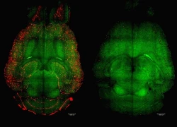 Nghiên cứu mở đường chữa khỏi bệnh Alzheimer