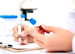 Những chỉ số máu quan trọng giúp quản lý HIV hiệu quả