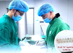 Tự đặt bi "tăng khoái cảm", người đàn ông 54 tuổi nhập viện cấp cứu