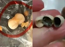 Liên tiếp các vụ phát hiện răng người trong đồ ăn gây xôn xao ở Trung Quốc