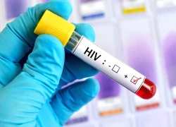 Những nước triển khai thuốc tiêm phòng HIV 'thần kỳ'