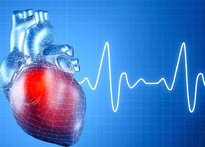 90% các ca đột tử có nguyên nhân từ bệnh tim mạch