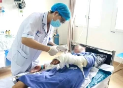 Bỏng nặng vì đốt rác bằng xăng