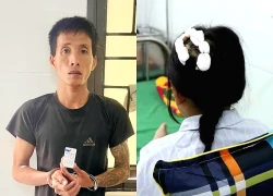 Khởi tố cha dượng dùng búa đinh bạo hành bé gái lớp 5
