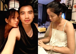 Hoa hậu H’Hen Niê sau khi bị biến dạng mặt