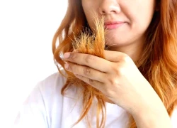 Tóc rụng như lá mùa thu, nhớ ăn 4 thực phẩm này thường xuyên