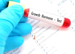 Trẻ thấp lùn do thiếu hụt hormone tăng trưởng