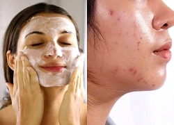 Cách làm sạch dầu trên da mặt an toàn và hiệu quả