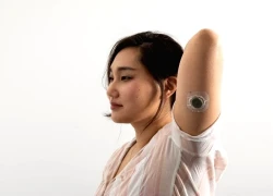 CGM: Thiết bị đeo tay giúp ích cho cuộc chiến chống lại bệnh đái tháo đường