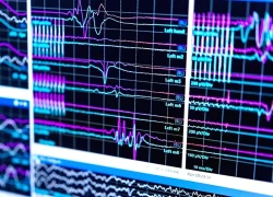 Góc nhìn khoa học về hiện tượng "cuộc đời vụt qua trước mắt" khi cận tử