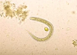 Khó thở và ho nhiều, đi khám bác sĩ phát hiện lý do không ngờ