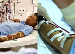 Sụp đổ với chẩn đoán suy thận giai đoạn cuối vì lý do không ai ngờ
