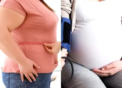 Mẹ béo phì trước khi mang thai, con tăng nguy cơ động kinh và khuyết tật