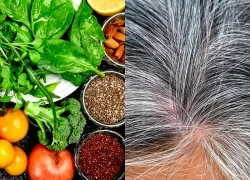 5 loại thực phẩm giúp ngăn ngừa tóc bạc sớm