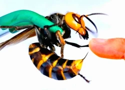 Cứu sống bé gái bị suy đa tạng do ong vò vẽ đốt