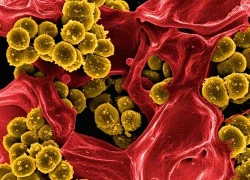 Trai trẻ rước họa vào thân vì tìm cách "tăng khoái cảm" phản khoa học