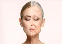 Các thực phẩm giúp chậm lão hóa, giảm nếp nhăn cho da