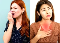 Đừng chủ quan trước những dấu hiệu trào ngược dạ dày thực quản