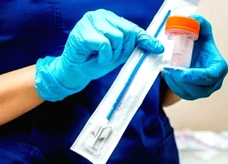 Ghi nhận ca viêm não cấp hiếm gặp do Parvovirus B19 ở Việt Nam